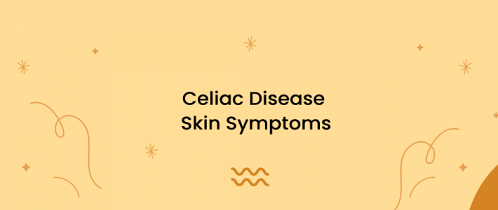 Celiac Disease Skin Symptoms